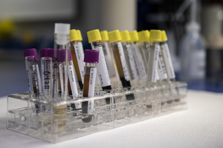 Θαλασσαιμία: Πάνω από 3.000 οι πάσχοντες στην Ελλάδα