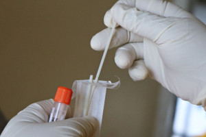 ΕΟΔΥ: Πού μπορείτε να κάνετε δωρεάν rapid test τo Σάββατο (16/12)