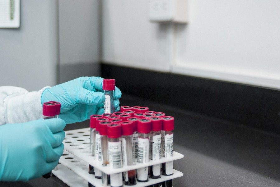 AIDS: Οι δραματικές επιπτώσεις από τις περικοπές στη διεθνή βοήθεια που παρέχουν οι ΗΠΑ