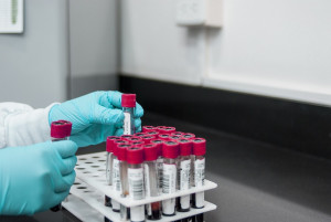 AIDS: Οι δραματικές επιπτώσεις από τις περικοπές στη διεθνή βοήθεια που παρέχουν οι ΗΠΑ