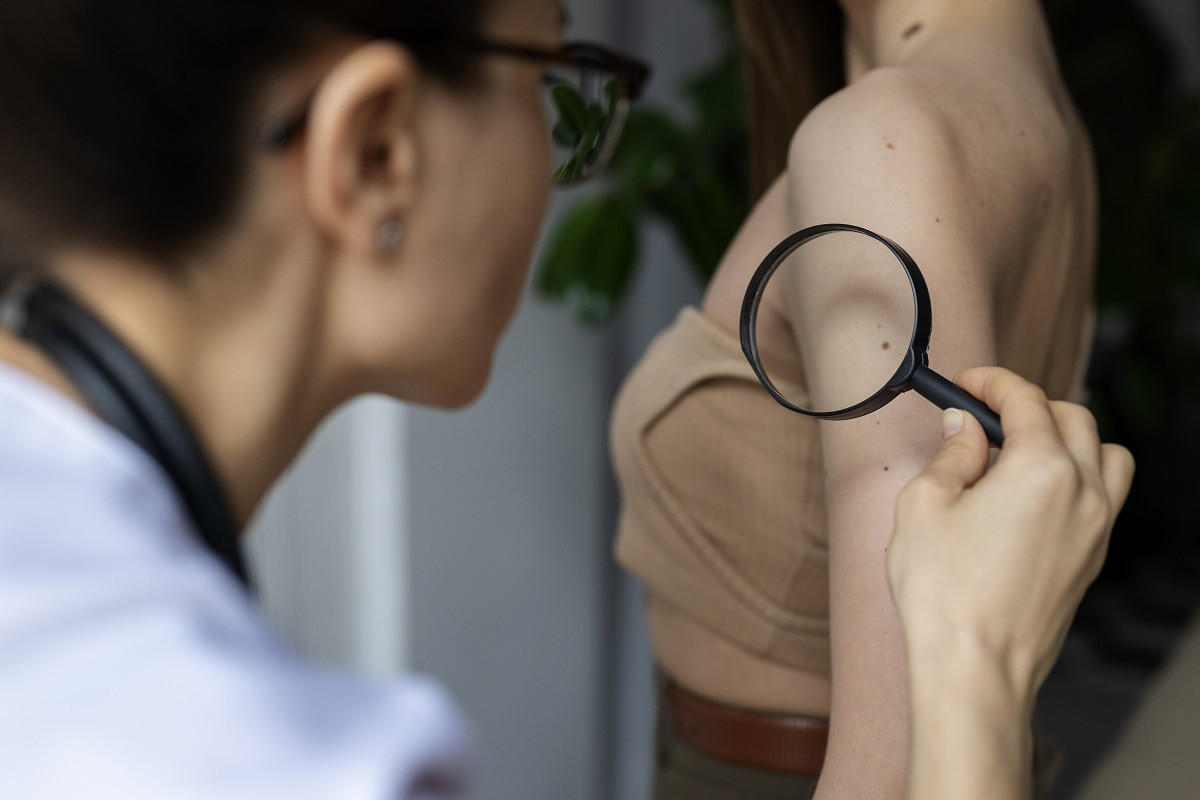 Πότε πρέπει να επισκεφθείτε τον γιατρό για έλεγχο μιας ελιάς;