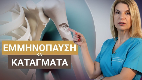 Έφη Ρομποτή: Τι είναι η οστεοπενία και τι η οστεοπόρωση