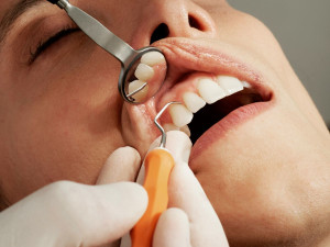 7 καθημερινές συνήθειες που βλάπτουν τα δόντια σας