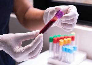 Οι Βρετανοί ενέκριναν την πρώτη στον κόσμο γονιδιακή θεραπεία για αιματολογικές διαταραχές