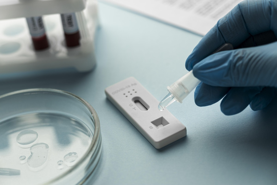 Κορωνοϊός: 93 εισαγωγές αυτή την εβδομάδα – 3 θάνατοι από γρίπη