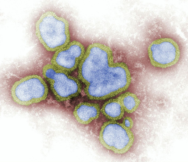 Γρίπη των πτηνών: Η επιτήρηση είναι καθοριστική για την πρόληψη της εξέλιξης του ιού