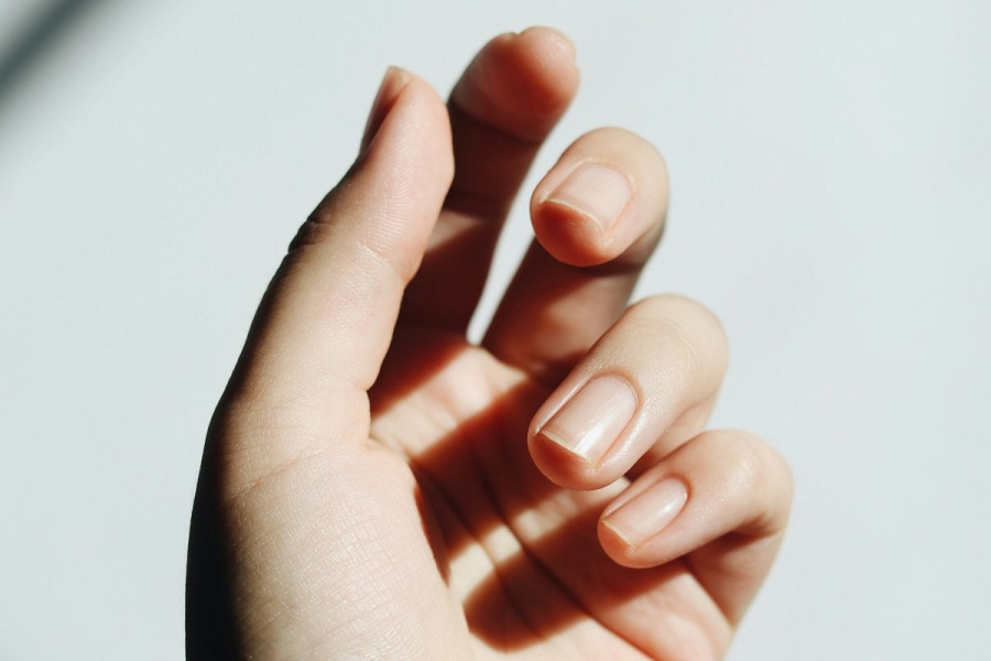 Λευκά σημάδια στα νύχια: Η διατροφική έλλειψη που μπορεί να τα προκαλεί