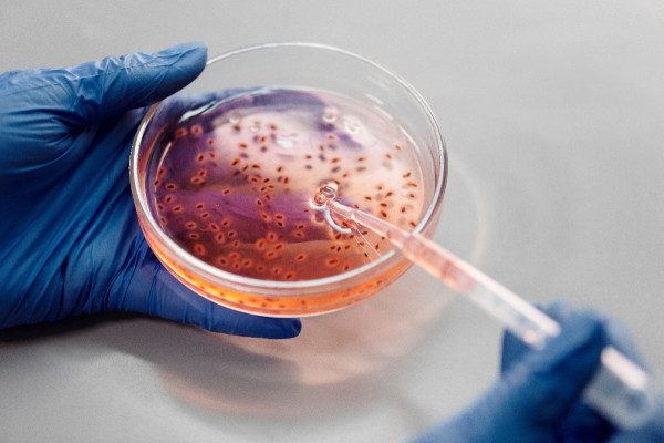 Καρκίνος: Τι γνωρίζουμε για τα βακτήρια και τους μύκητες μέσα στους όγκους