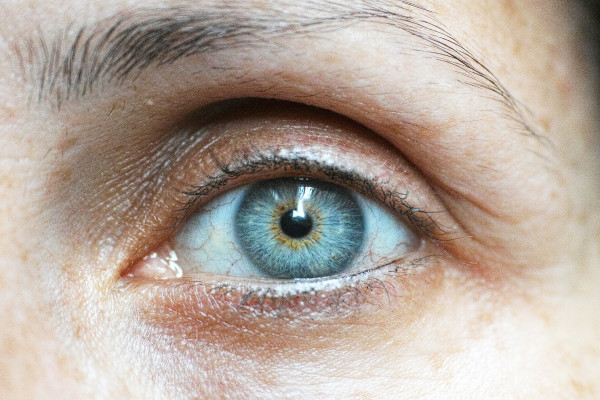 Αλτσχάιμερ: Καλά νέα για όσους υποφέρουν από προβλήματα όρασης