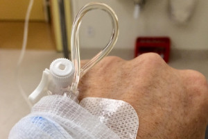 Καρκίνος: Εντυπωσιακή μείωση της θνησιμότητας στις ΗΠΑ – Οι μορφές με τη μεγαλύτερη πρόοδο