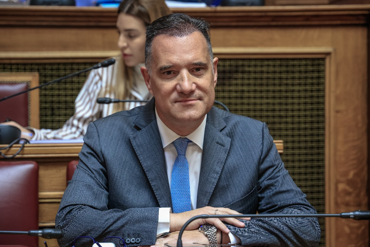 Άδωνις Γεωργιάδης: Υποβλήθηκε σε μεταμόσχευση μαλλιών