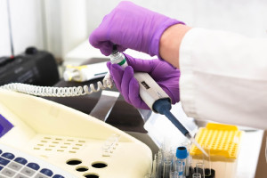 Xολαγγειοκαρκίνωμα: Έγκριση νέου διειδικού μονοκλωνικού αντισώματος από τον FDA