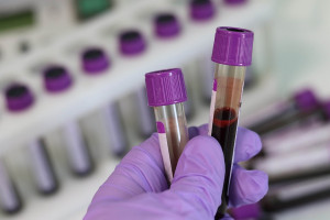 Παγκόσμια Ημέρα Θαλασσαιμίας η 8η Μαΐου – 4000 άτομα ζουν με Θαλασσαιμία στην Ελλάδα