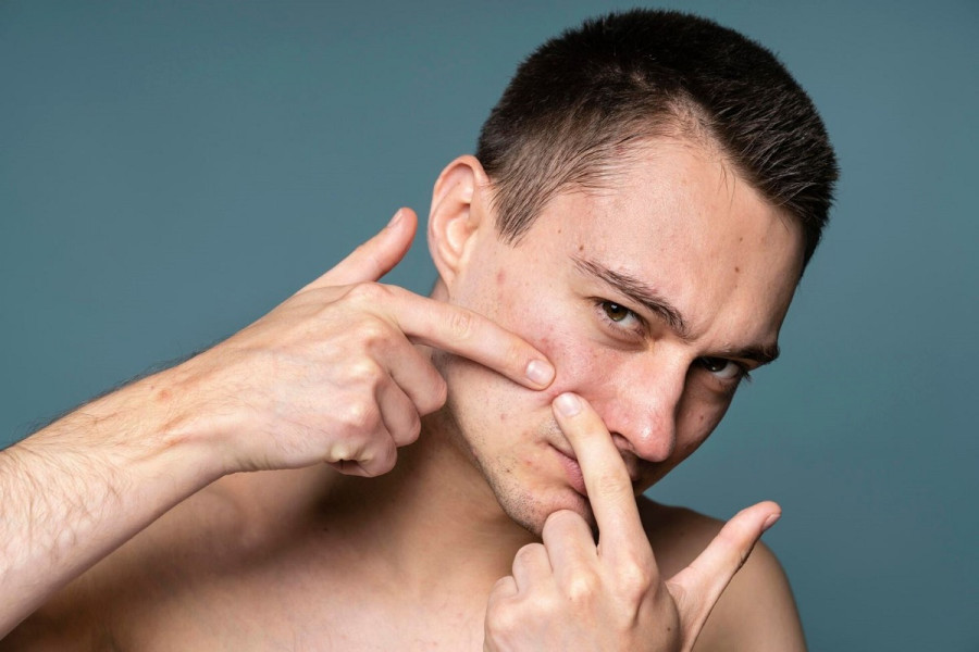 Τι συμβαίνει στο δέρμα σας όταν «σπάτε» ένα σπυράκι