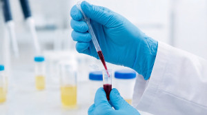 ASCO 2026: Οι μελέτες που αλλάζουν το θεραπευτικό τοπίο του καρκίνου των πνευμόνων