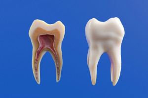 Μπορεί ένα χαλασμένο δόντι να οδηγήσει σε θάνατο;