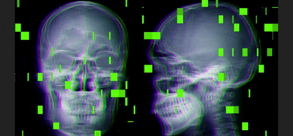 Η AI στις χειρουργικές αίθουσες – Οι κίνδυνοι για τους ασθενείς