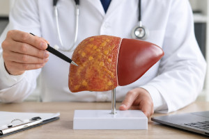 Λίπος στο συκώτι: Δύο κοινά φάρμακα μπορούν να αναστρέψουν τη νόσο – Τι έδειξε μελέτη