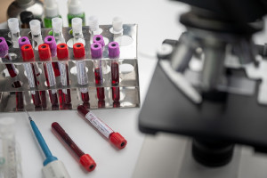 ΕΟΔΥ: Εαρινή Ευρωπαϊκή Εβδομάδα Εξέτασης 2025 για τα ΣΜΝ