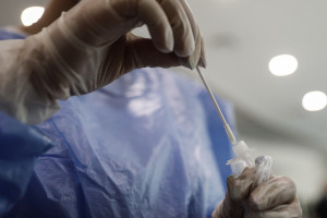 Γρίπη: Σε εγρήγορση οι αρχές - Έρχεται το δεύτερο κύμα