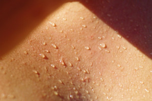 Έξυπνα tips για να διαχειριστείτε την υπερβολική εφίδρωση