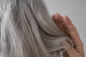 Η βιταμίνη που μειώνει τα λευκά μαλλιά - Σε ποιες τροφές θα τη βρείτε