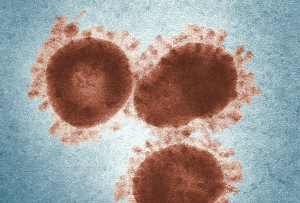 Ο ιός που μολύνει περίπου το 95% των ανθρώπων - Δείτε τι προκαλεί