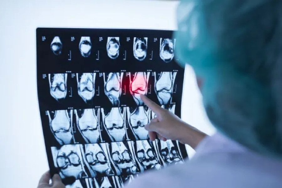 Ηνωμένο Βασίλειο: Νέες κατευθυντήριες οδηγίες για την αναγνώριση των συμπτωμάτων του παιδικού καρκίνου των οστών