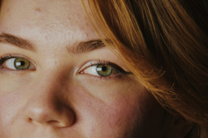 Λίπος στο συκώτι: Τα άγνωστα συμπτώματα που μπορεί να δείτε στο πρόσωπό σας