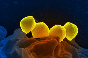 Στρεπτόκοκκος Granulicatella Adiacens: Τα συμπτώματα και η αντιμετώπιση του επικίνδυνου βακτηρίου