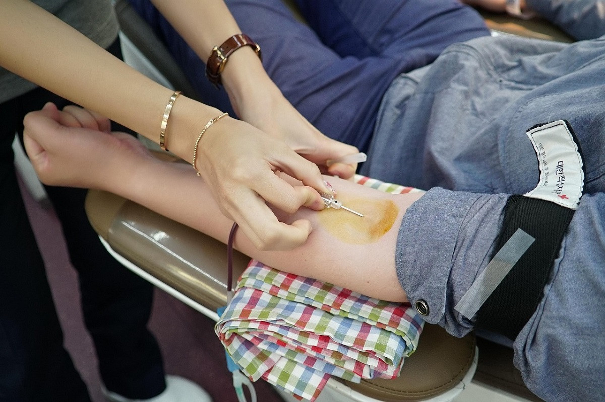 Πλασμαφαίρεση: Τι είναι – Πως πραγματοποιείται – Οι πιο συχνές παρενέργειες