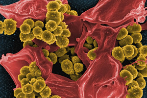 Το μικροβίωμα και το μέλλον της εξατομικευμένης ιατρικής