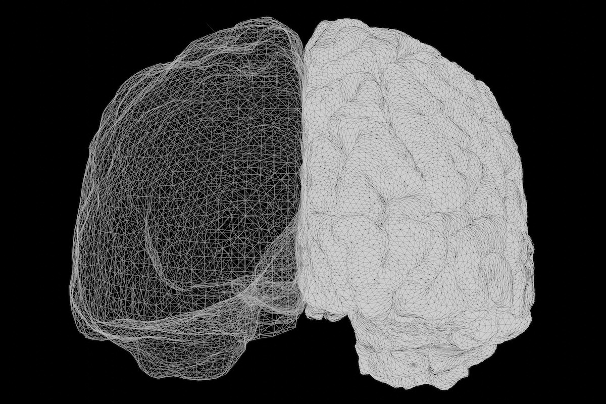 Η σχιζοφρένεια συνδέεται με χαμηλά επίπεδα 2 ουσιών στον εγκέφαλο