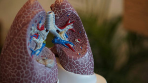 Κατάρρευση πνευμόνων: Αιτίες, συμπτώματα και θεραπεία