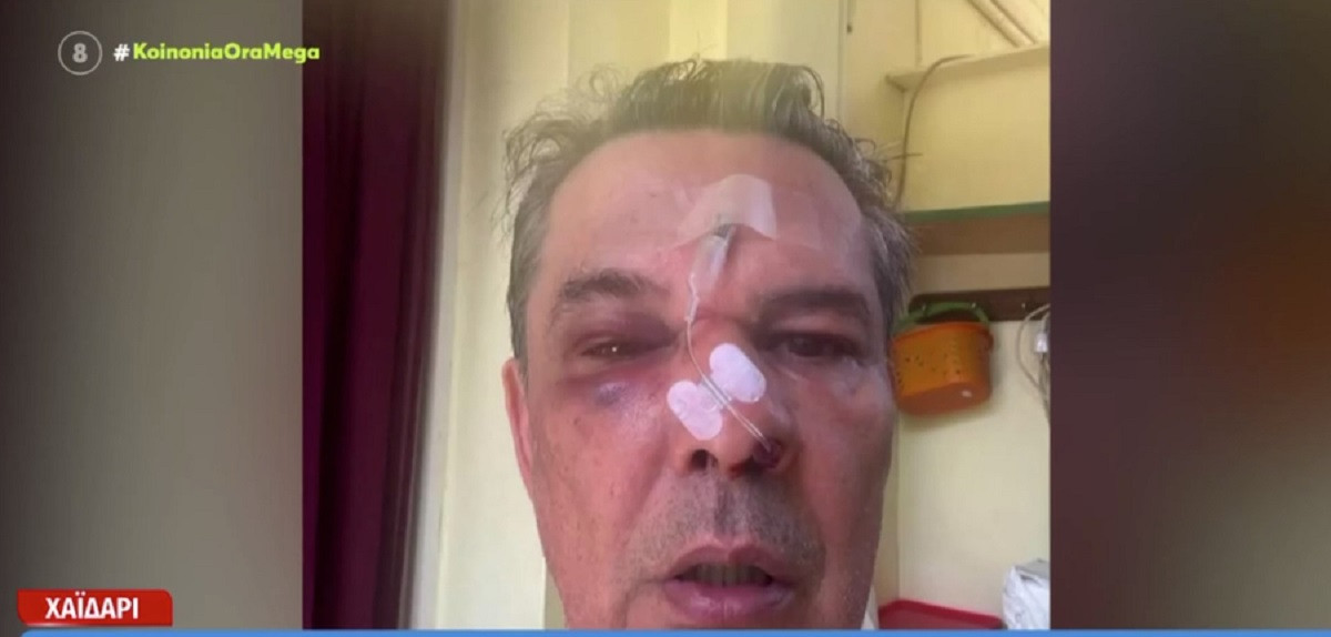 Χαϊδάρι: Απίστευτος ξυλοδαρμός σε ιατρείο - Του επιτέθηκε γιατί του έκανε παρατήρηση να μιλά πιο σιγά στο κινητό
