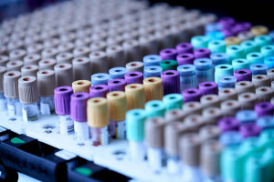 Ευλογιά των πιθήκων (Mpox): Αυξάνεται το φορτίο – 160 τα κρούσματα στην Ελλάδα