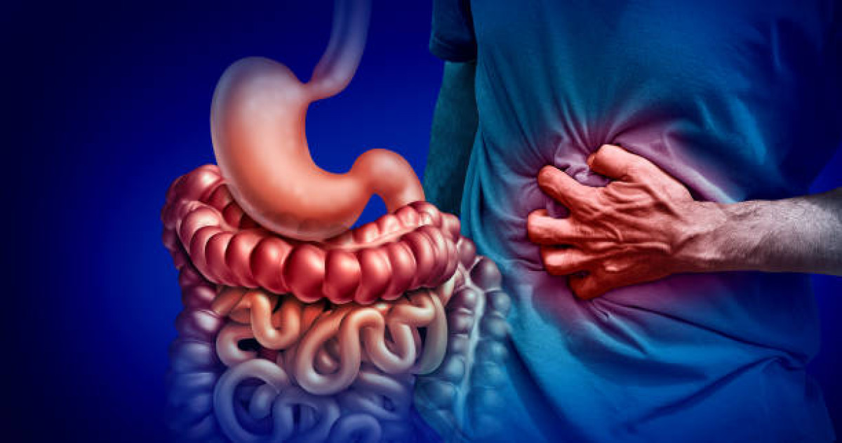Νόσος του Crohn: Ποιά συμπτώματα πρέπει να σας απασχολήσουν σοβαρά