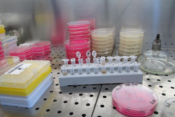 Λιστερίωση: Σε άνοδο στην Ευρώπη – Οι παράγοντες που οδηγούν σε αύξηση κρουσμάτων